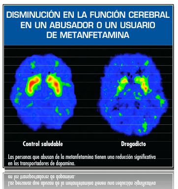 receptores de dopamina y metanfetamina